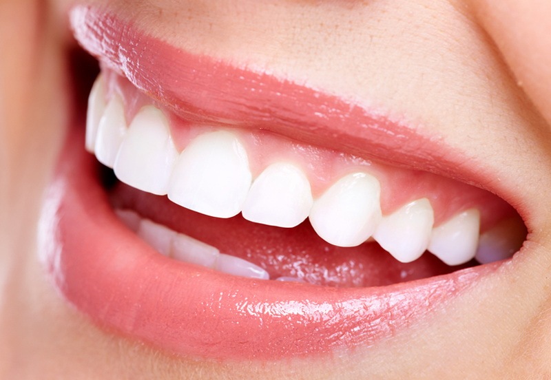 Invisalign Cost